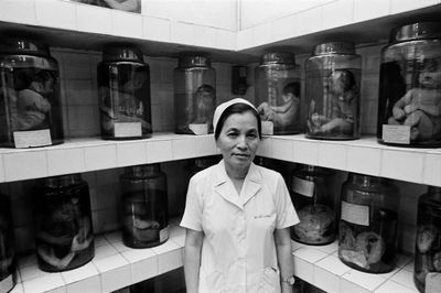 Vào năm 1989, bệnh viện Từ Dũ gắn liền với các nghiên cứu về dị tật bẩm sinh ở trẻ sơ sinh, rất...