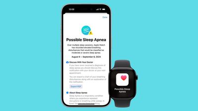 Apple Watch tại Việt Nam đã có tính năng phát hiện ngưng thở khi ngủ