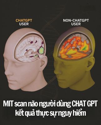 Nghiên cứu của MIT công bố tháng 6/2025 trên 54 người tham gia (dùng EEG trong lúc viết bài luận)...