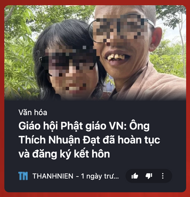 Quả răng này ai dám hôn cũng chảy máu lợi mất thôi